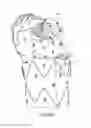 Fig. 29 - Method for aortic branched vessel repair