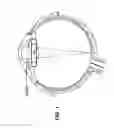 Fig. 02 - Intraocular lens system with folding features