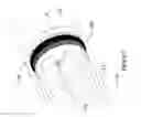 Fig. 07 - Intraocular lens insertion device