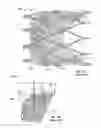 Fig. 02 - Leaflet-cuff attachments for prosthetic heart valve