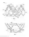 Fig. 04 - Leaflet-cuff attachments for prosthetic heart valve