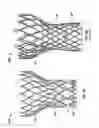 Fig. 05 - Leaflet-cuff attachments for prosthetic heart valve