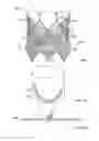 Fig. 06 - Leaflet-cuff attachments for prosthetic heart valve