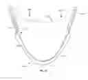 Fig. 14 - Leaflet-cuff attachments for prosthetic heart valve