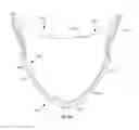 Fig. 15 - Leaflet-cuff attachments for prosthetic heart valve