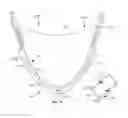 Fig. 16 - Leaflet-cuff attachments for prosthetic heart valve