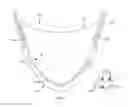 Fig. 17 - Leaflet-cuff attachments for prosthetic heart valve