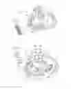 Fig. 07 - Mitral valve treatment techniques
