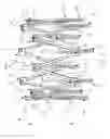 Fig. 02 - Implantable device and delivery system for reshaping a heart valve annulus