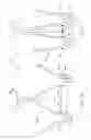 Fig. 16 - Implantable device and delivery system for reshaping a heart valve annulus