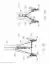 Fig. 20 - Implantable device and delivery system for reshaping a heart valve annulus