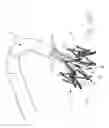 Fig. 24 - Implantable device and delivery system for reshaping a heart valve annulus