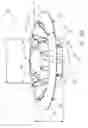 Fig. 41 - Implantable device and delivery system for reshaping a heart valve annulus