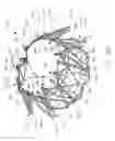 Fig. 46 - Implantable device and delivery system for reshaping a heart valve annulus