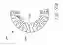 Fig. 50 - Implantable device and delivery system for reshaping a heart valve annulus