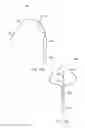 Fig. 13 - Systems and devices for setting an anchor