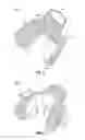 Fig. 04 - Void filling joint prosthesis and associated instruments