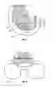 Fig. 05 - Void filling joint prosthesis and associated instruments
