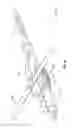 Fig. 09 - Void filling joint prosthesis and associated instruments