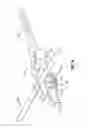 Fig. 12 - Void filling joint prosthesis and associated instruments