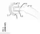 Fig. 02 - Femoral heads, mobile inserts, acetabular components, and modular junctions for orthopedic implants and methods of using femoral heads, mobile insets, acetabular components, and modular junctions for orthopedic implants
