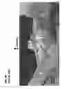 Fig. 06 - Femoral heads, mobile inserts, acetabular components, and modular junctions for orthopedic implants and methods of using femoral heads, mobile insets, acetabular components, and modular junctions for orthopedic implants