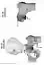 Fig. 07 - Femoral heads, mobile inserts, acetabular components, and modular junctions for orthopedic implants and methods of using femoral heads, mobile insets, acetabular components, and modular junctions for orthopedic implants