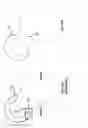Fig. 17 - Femoral heads, mobile inserts, acetabular components, and modular junctions for orthopedic implants and methods of using femoral heads, mobile insets, acetabular components, and modular junctions for orthopedic implants
