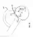 Fig. 31 - Femoral heads, mobile inserts, acetabular components, and modular junctions for orthopedic implants and methods of using femoral heads, mobile insets, acetabular components, and modular junctions for orthopedic implants