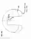 Fig. 35 - Femoral heads, mobile inserts, acetabular components, and modular junctions for orthopedic implants and methods of using femoral heads, mobile insets, acetabular components, and modular junctions for orthopedic implants