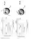 Fig. 45 - Femoral heads, mobile inserts, acetabular components, and modular junctions for orthopedic implants and methods of using femoral heads, mobile insets, acetabular components, and modular junctions for orthopedic implants