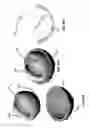 Fig. 47 - Femoral heads, mobile inserts, acetabular components, and modular junctions for orthopedic implants and methods of using femoral heads, mobile insets, acetabular components, and modular junctions for orthopedic implants
