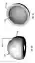 Fig. 55 - Femoral heads, mobile inserts, acetabular components, and modular junctions for orthopedic implants and methods of using femoral heads, mobile insets, acetabular components, and modular junctions for orthopedic implants