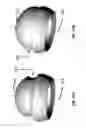 Fig. 56 - Femoral heads, mobile inserts, acetabular components, and modular junctions for orthopedic implants and methods of using femoral heads, mobile insets, acetabular components, and modular junctions for orthopedic implants