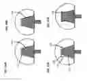 Fig. 63 - Femoral heads, mobile inserts, acetabular components, and modular junctions for orthopedic implants and methods of using femoral heads, mobile insets, acetabular components, and modular junctions for orthopedic implants