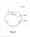 Fig. 25 - Expandable fusion device and method of installation thereof