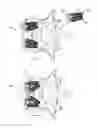 Fig. 06 - Expandable spinal implant