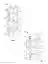 Fig. 04 - Systems and methods for treating spinal deformities
