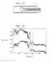 Fig. 08 - DEVICES AND METHODS FOR CONTROL OF BLOOD PRESSURE