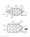 Fig. 14 - DEVICES, SYSTEMS, AND METHODS TO PRECONDITION, ARTERIALIZE, AND/OR OCCLUDE A MAMMALIAN LUMINAL ORGAN