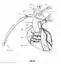 Fig. 34 - Apparatus and method for stabilization of procedural catheter in tortuous vessels