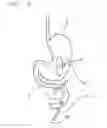 Fig. 07 - Medical instrument