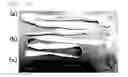 Fig. 11 - Medical instrument