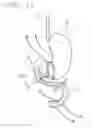 Fig. 13 - Medical instrument