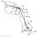 Fig. 01 - Plantar fasciitis treatment method and device