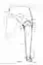 Fig. 02 - Plantar fasciitis treatment method and device