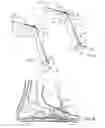 Fig. 04 - Plantar fasciitis treatment method and device