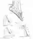 Fig. 05 - Plantar fasciitis treatment method and device
