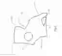 Fig. 04 - BRACE OR SUPPORT WITH ATFL SUPPORT