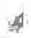 Fig. 26 - BRACE OR SUPPORT WITH ATFL SUPPORT